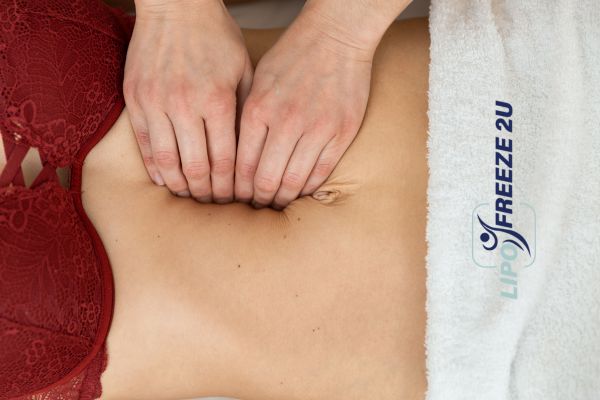 diastasis recti treatment Fulham