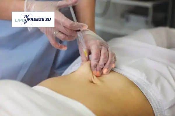 Fat Dissolving Injections Fulham & Weight loss medication