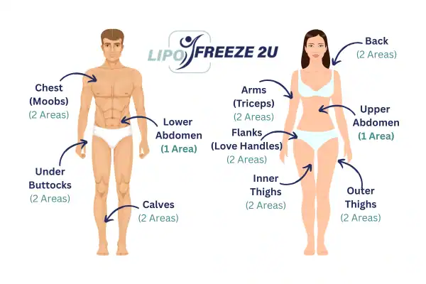 Areas you can have fat freezing treatment Fulham