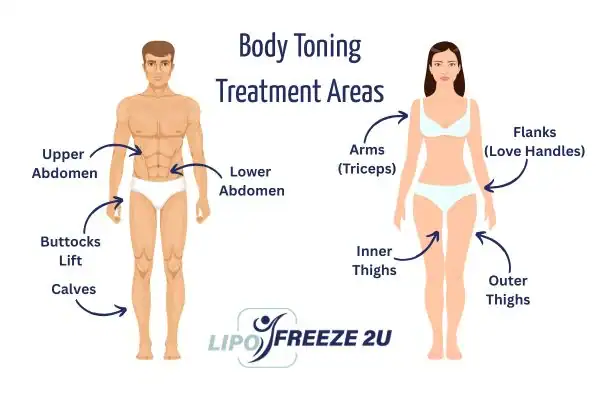 Graphic showing where you can have Body toning Treatment Fulham on your body