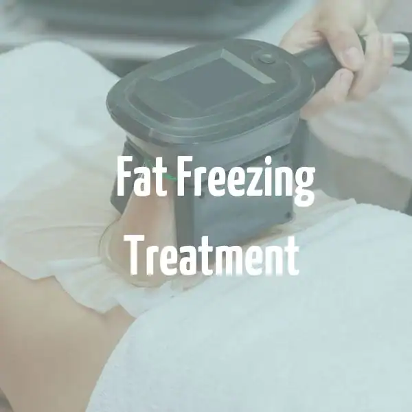 fat freezing treatment Fulham
