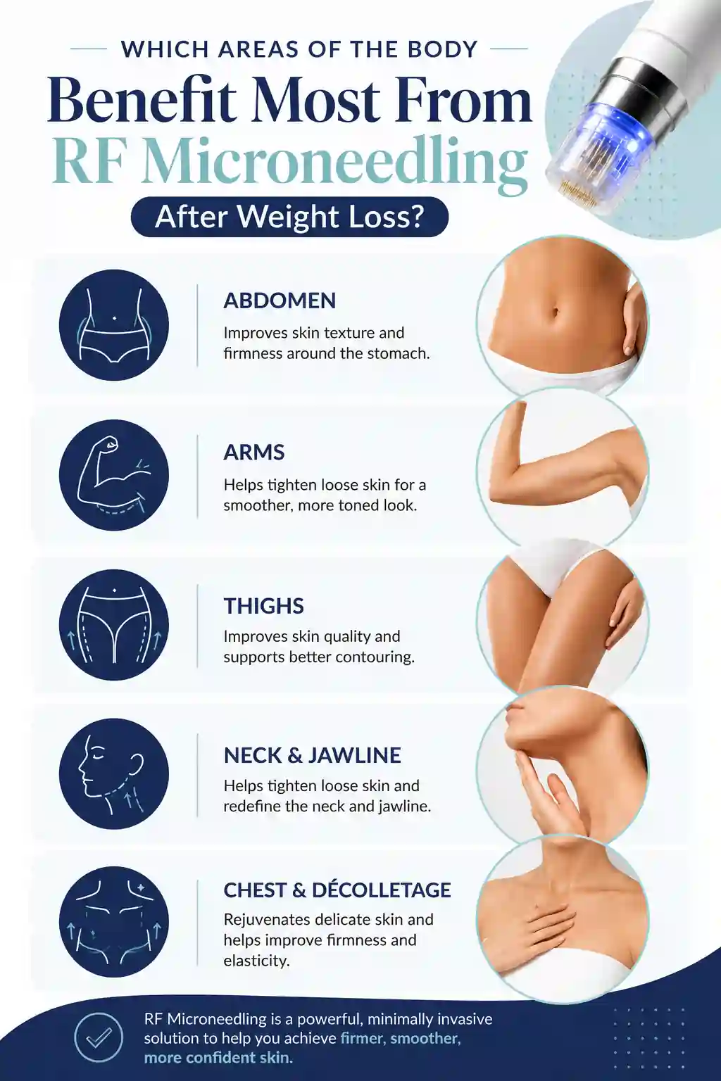 Which Areas of the Body Benefit Most From RF Microneedling After Weight Loss Fulham